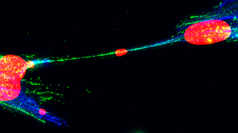 Damaged DNA can spread between human cells. What could that mean for cancer?