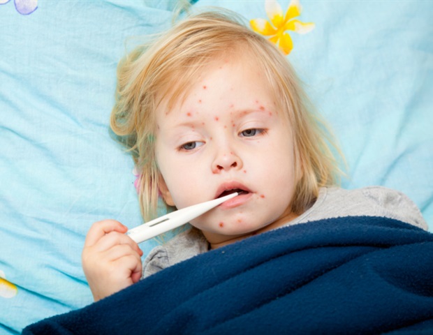 New oral antiviral drug candidate targets measles and Croup syndrome