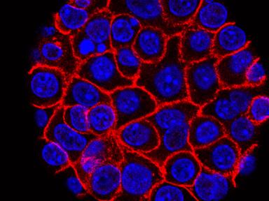 Experimental pill promises new hope for deadly pancreatic cancer