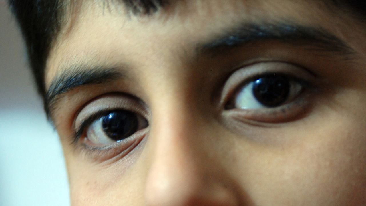 Diagnostic dilemma: Doctors couldn’t explain why a boy was bleeding from his eyes, ears and nose