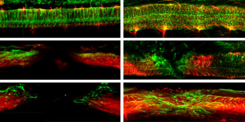 In Animal Study, Nanobots Repair Spinal Cords