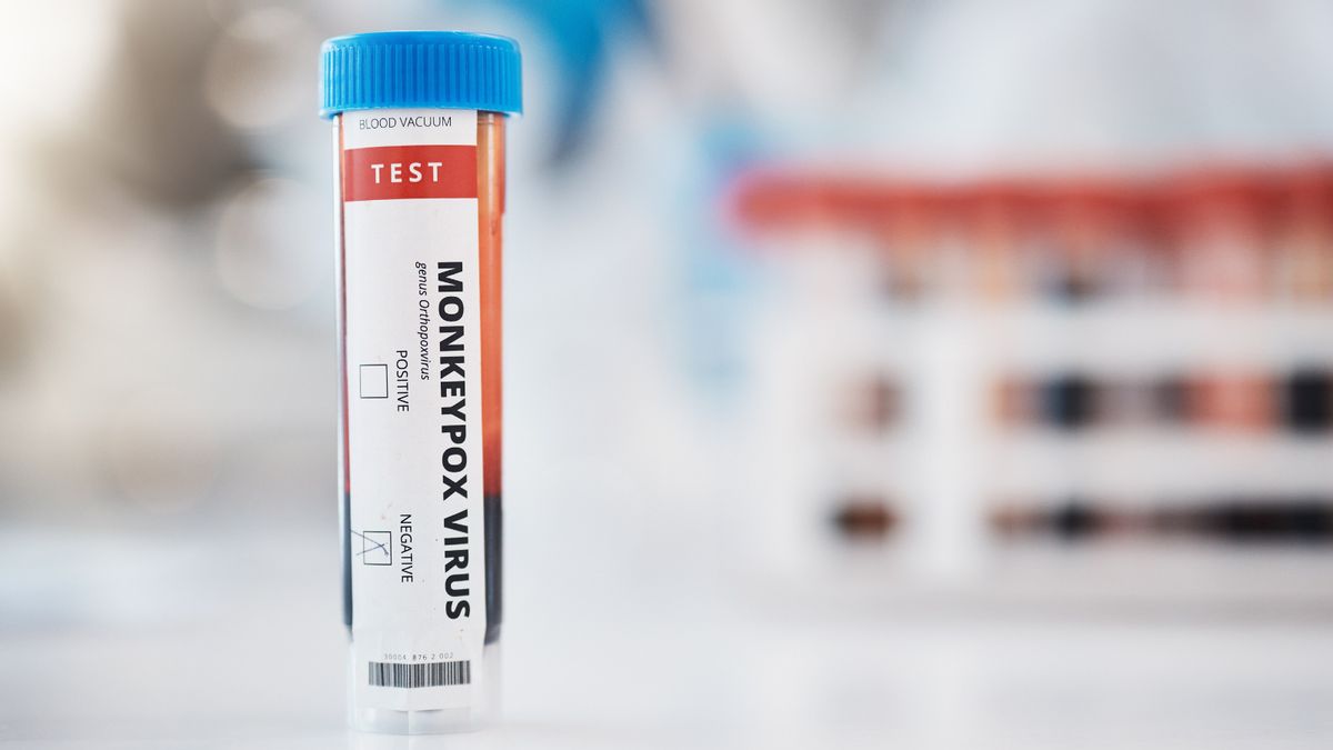 DOJ charged 2 NIH scientists with smuggling deactivated monkeypox virus into US