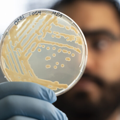 Some ancient microbes frozen with Ötzi the Iceman are still growing