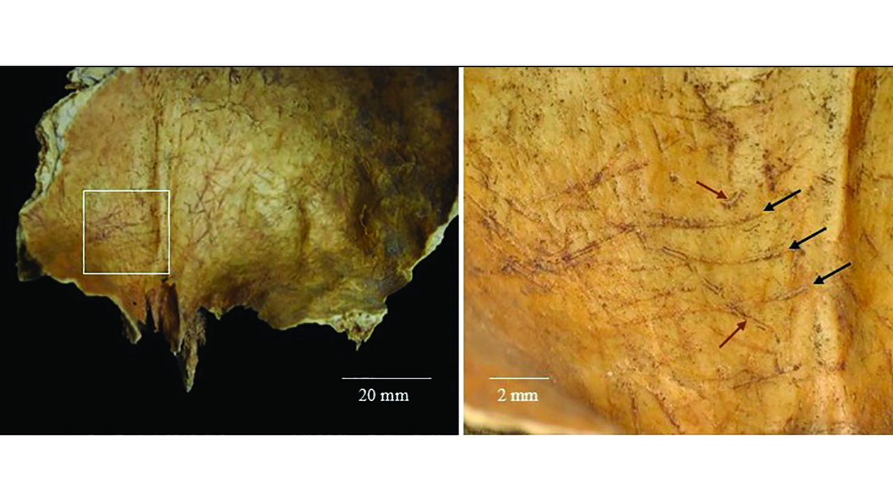 2,000 years ago in Scotland, people removed a corpse’s brain and fashioned the arm bones into tools