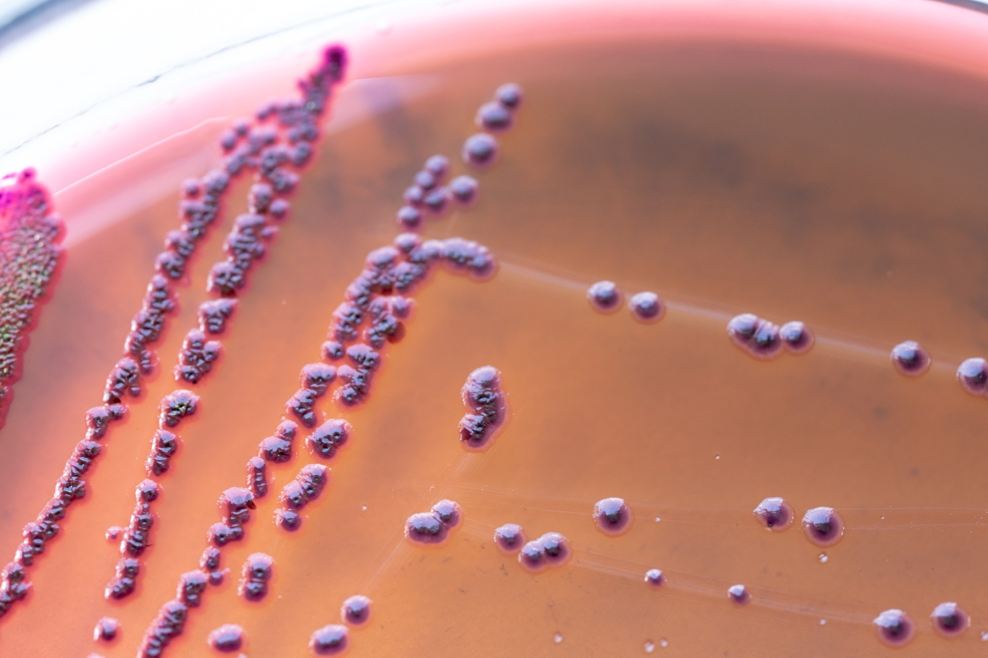 Gut bacteria may help explain why fatigue appears before illness