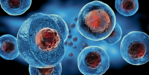 Stem Cell Therapy for Autism