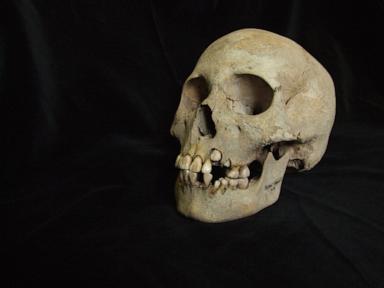 Ancient teeth rewrite the plague’s timeline, dating back to over 5,500 years ago