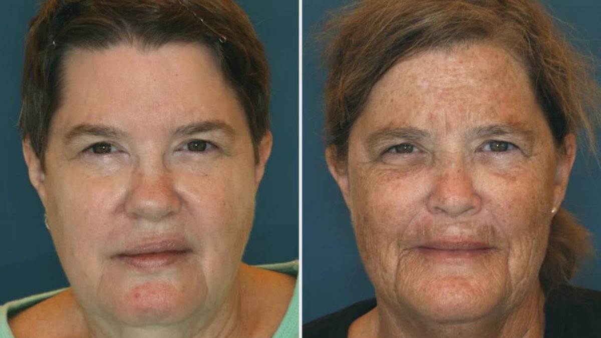 Do photos of identical twins show effects of sun exposure, smoking? Here’s the real story