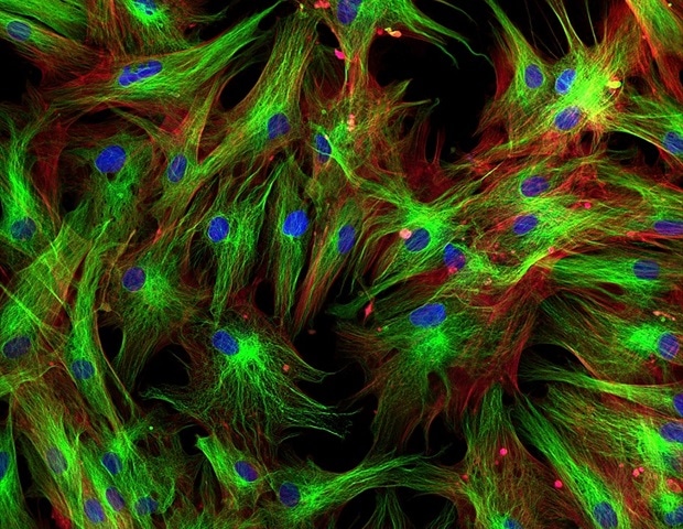 Modulating pathogenic scar cells promotes spinal cord regeneration
