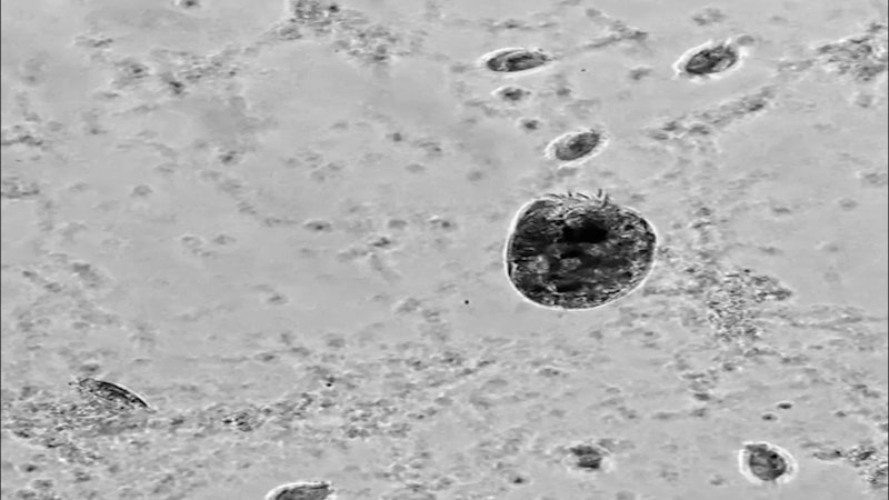This microbe turns into a cannibalistic ‘Hulk’