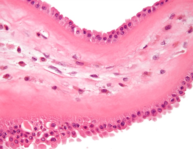 New AI framework outperforms conventional biomarkers in predicting cancer survival