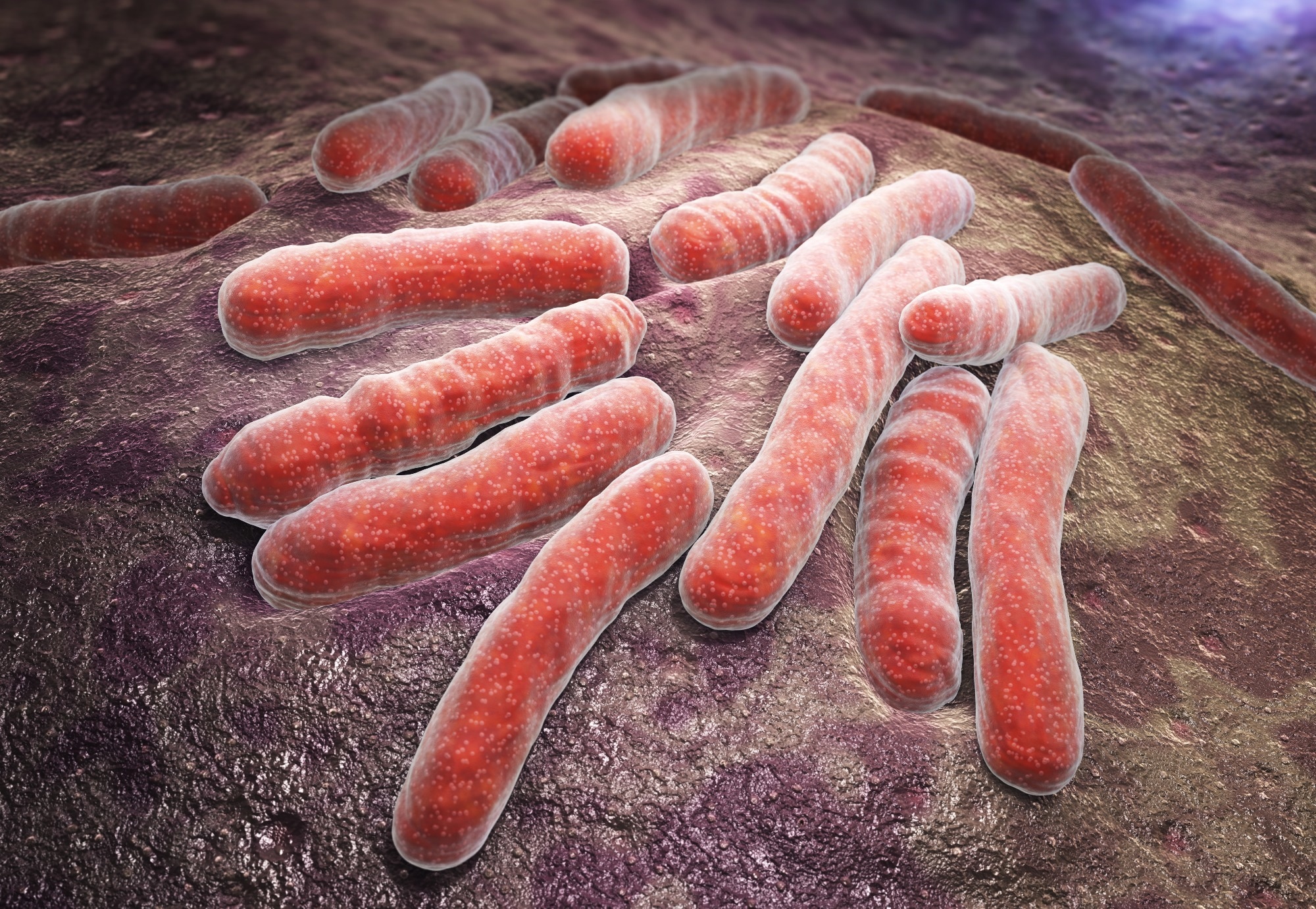 Study links severe COVID to higher TB risk, and vaccination appears to blunt the link