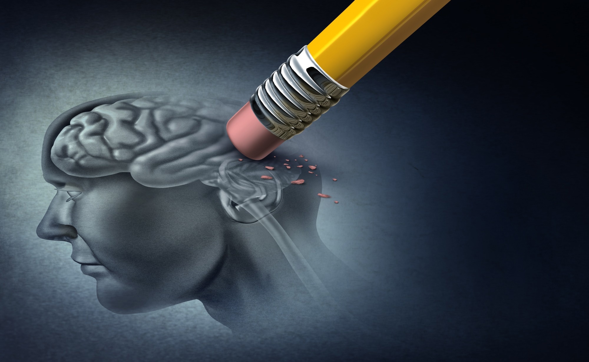 A wife’s account reveals the hidden burden of young-onset Alzheimer’s caregiving