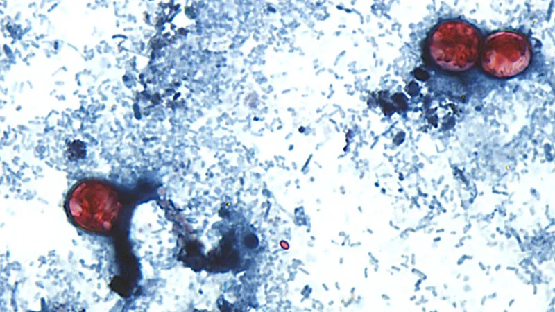 Inside the fight against the parasite Cyclospora