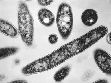 First death reported in Legionnaires’ disease outbreak in New York City