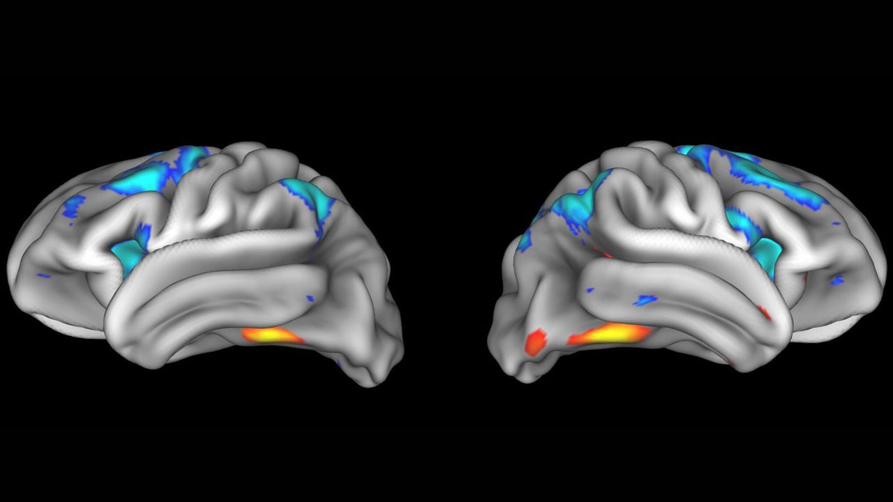 Neuroscience findings often can’t be replicated ‪—‬ and it’s a big problem for what we know about the brain