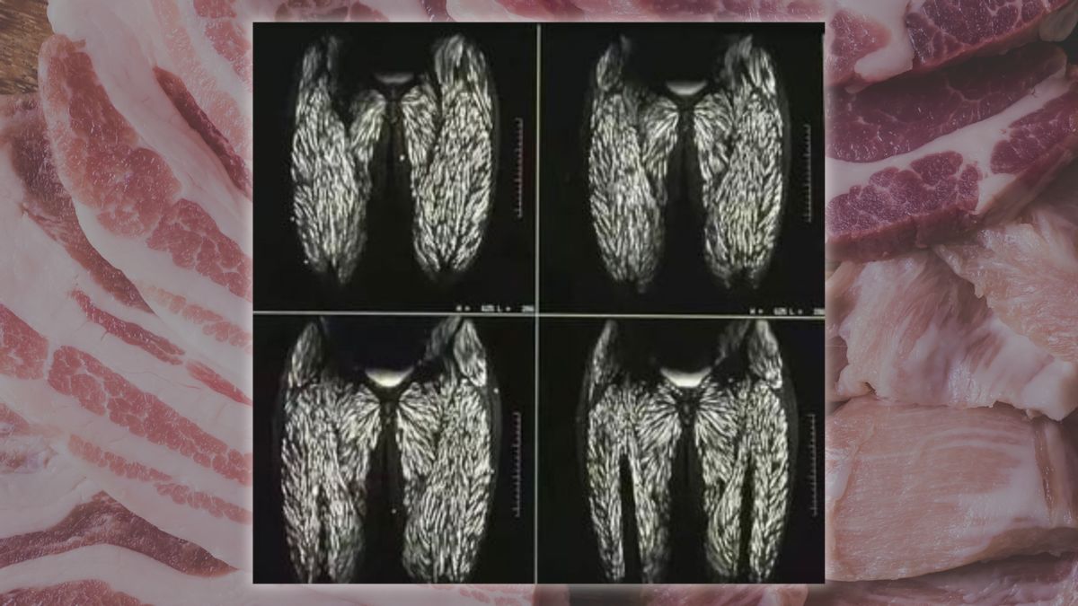 Do scans show woman’s body infected with parasites after she ate raw pork for a decade?