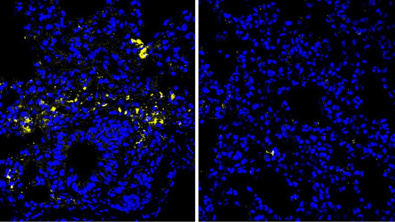 How one amino acid might help fight colon cancer and infections
