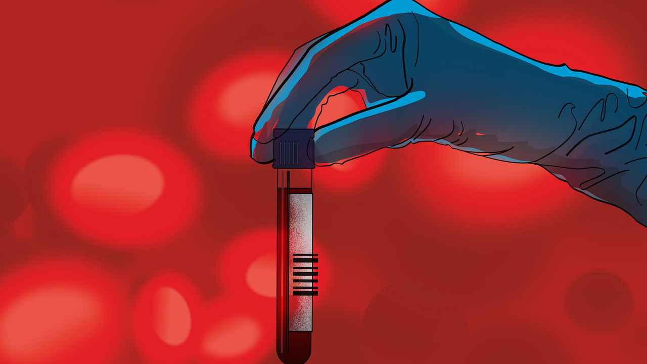 Alzheimer’s blood tests are transforming how patients get diagnosed — here’s what to know