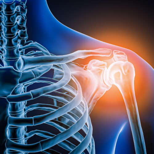Doctors took a look at man’s painful shoulder—they found the joint was missing