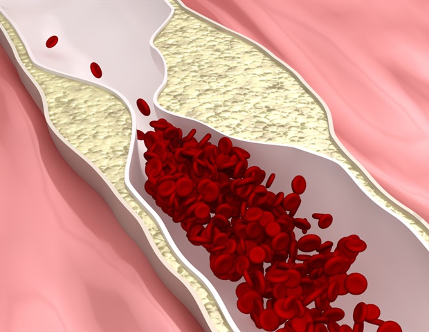 Review explores mechanisms driving cardiovascular aging and disease risk
