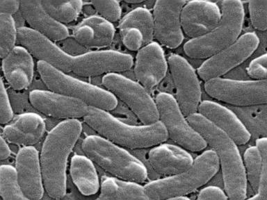 Health officials urge caution for Gulf Coast beachgoers during surge of deadly bacterial infections