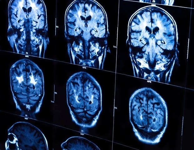 Astrocytes found to directly regulate memory consolidation during sleep