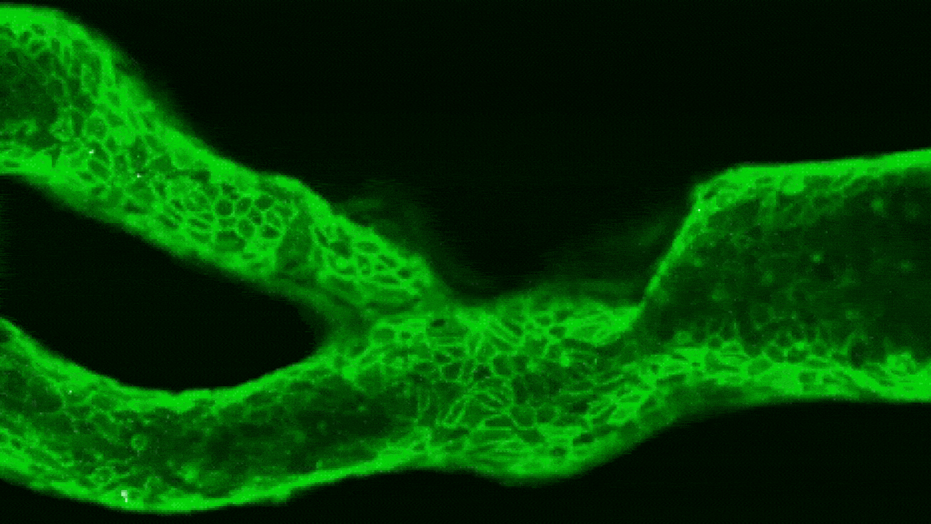 Mini ‘arteries-on-a-chip’ could help predict a person’s risk of stroke