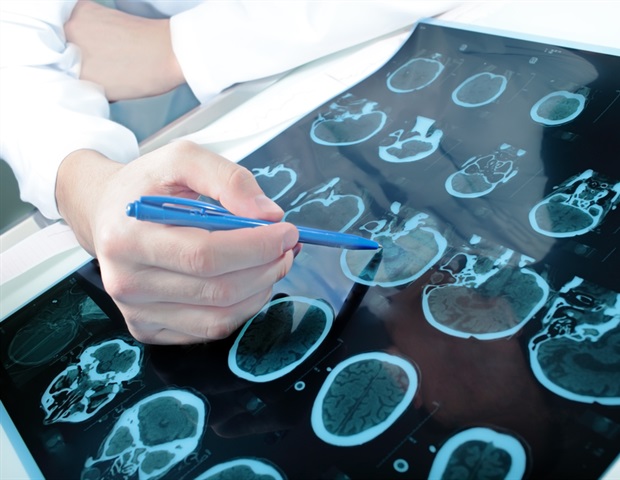 Shared protein pathology redefines treatment for multiple neurodegenerative diseases