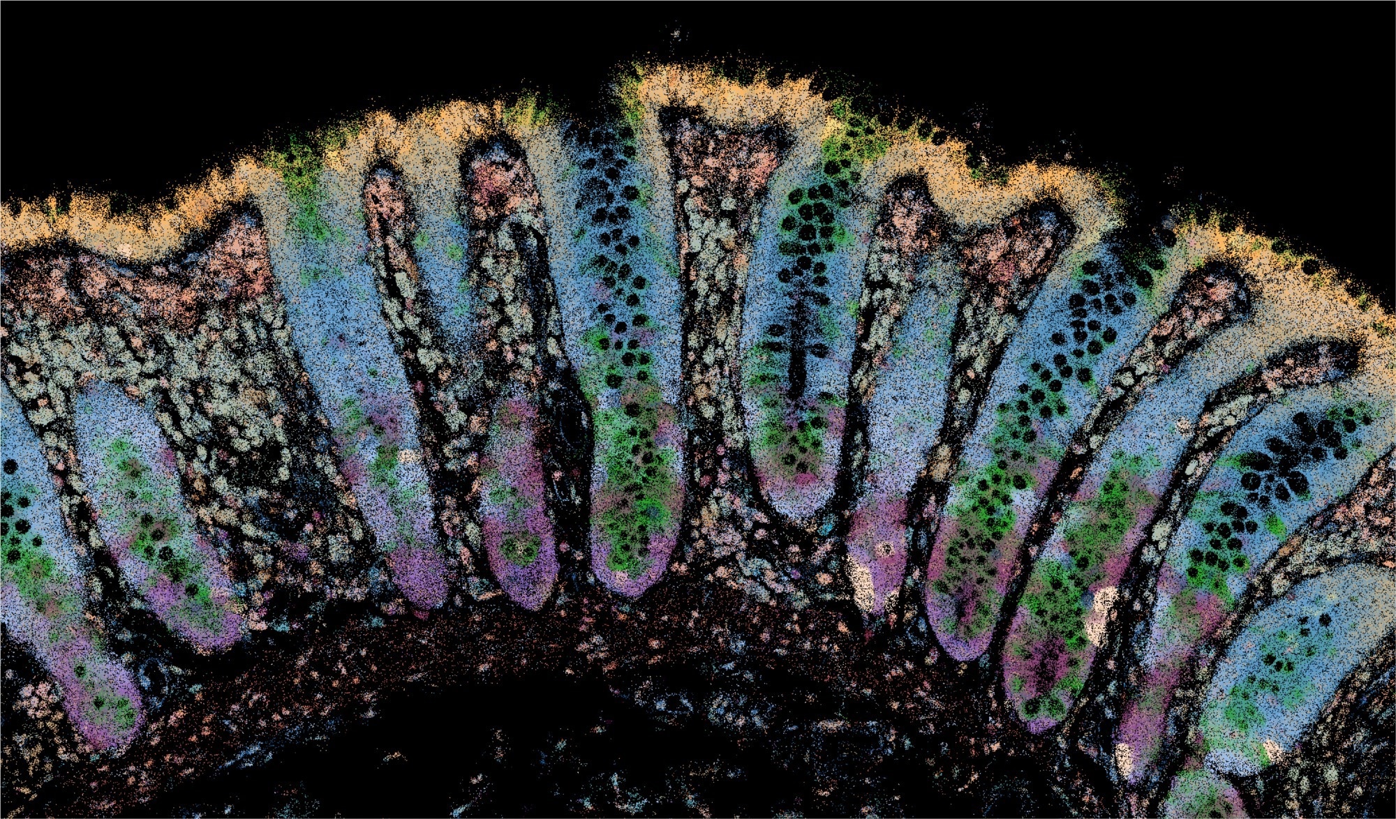 Researchers identify early molecular warning signs of inflammatory bowel disease