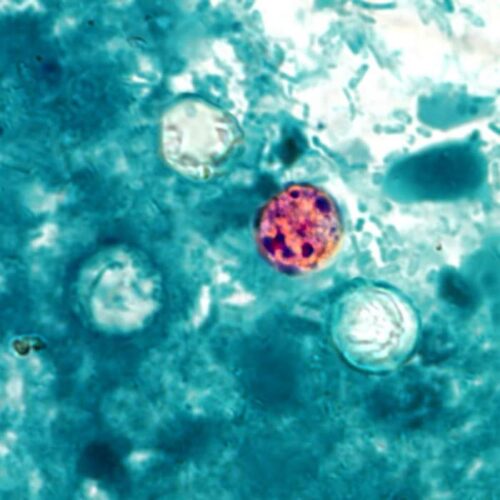 Trump admin shelves Cyclospora research despite record-breaking outbreak