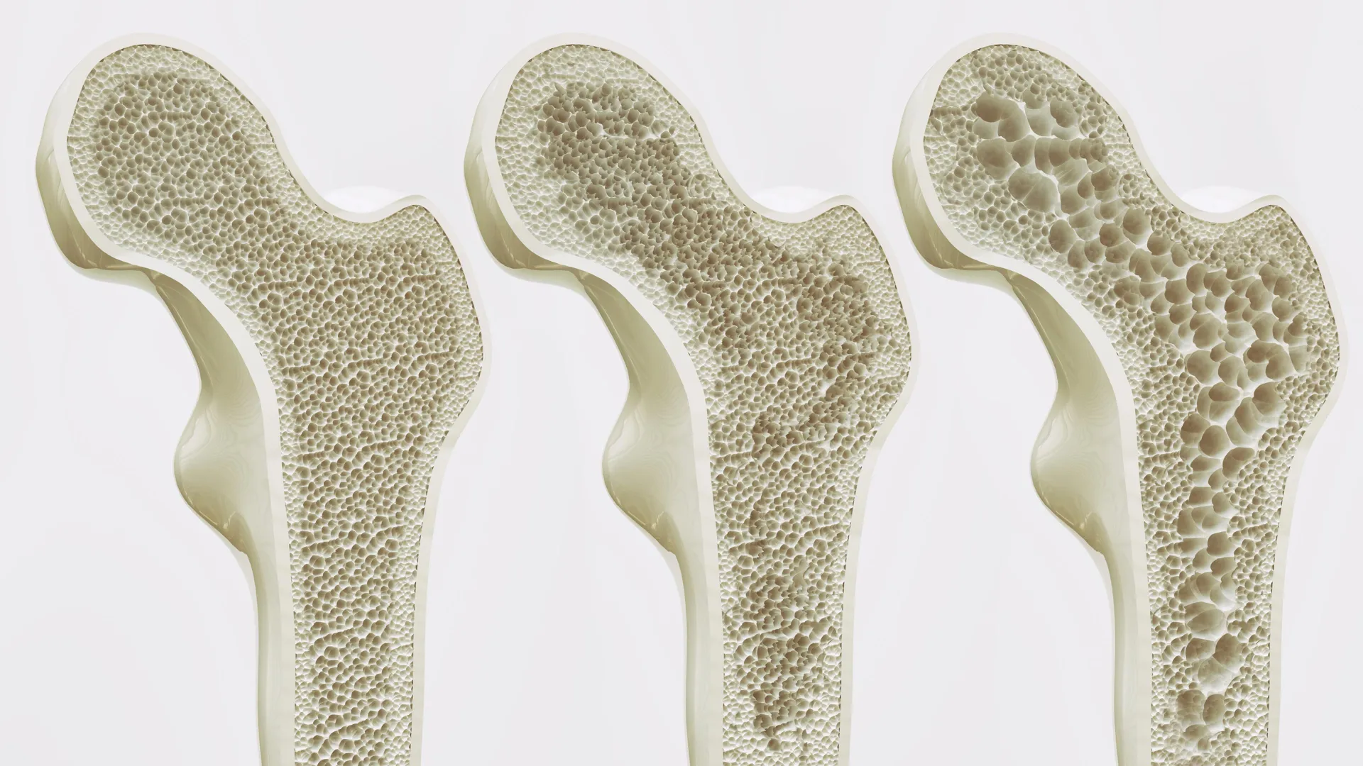 too-much-coffee-may-weaken-bones,-study-finds