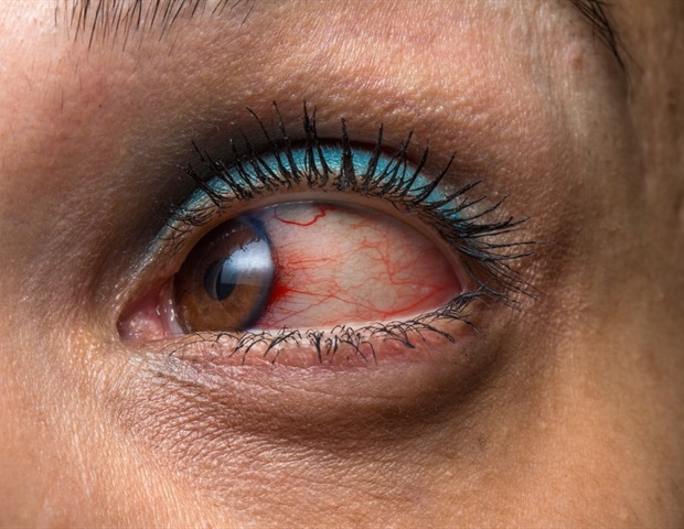 Retinal immune cell gateway may unlock targeted uveitis treatments