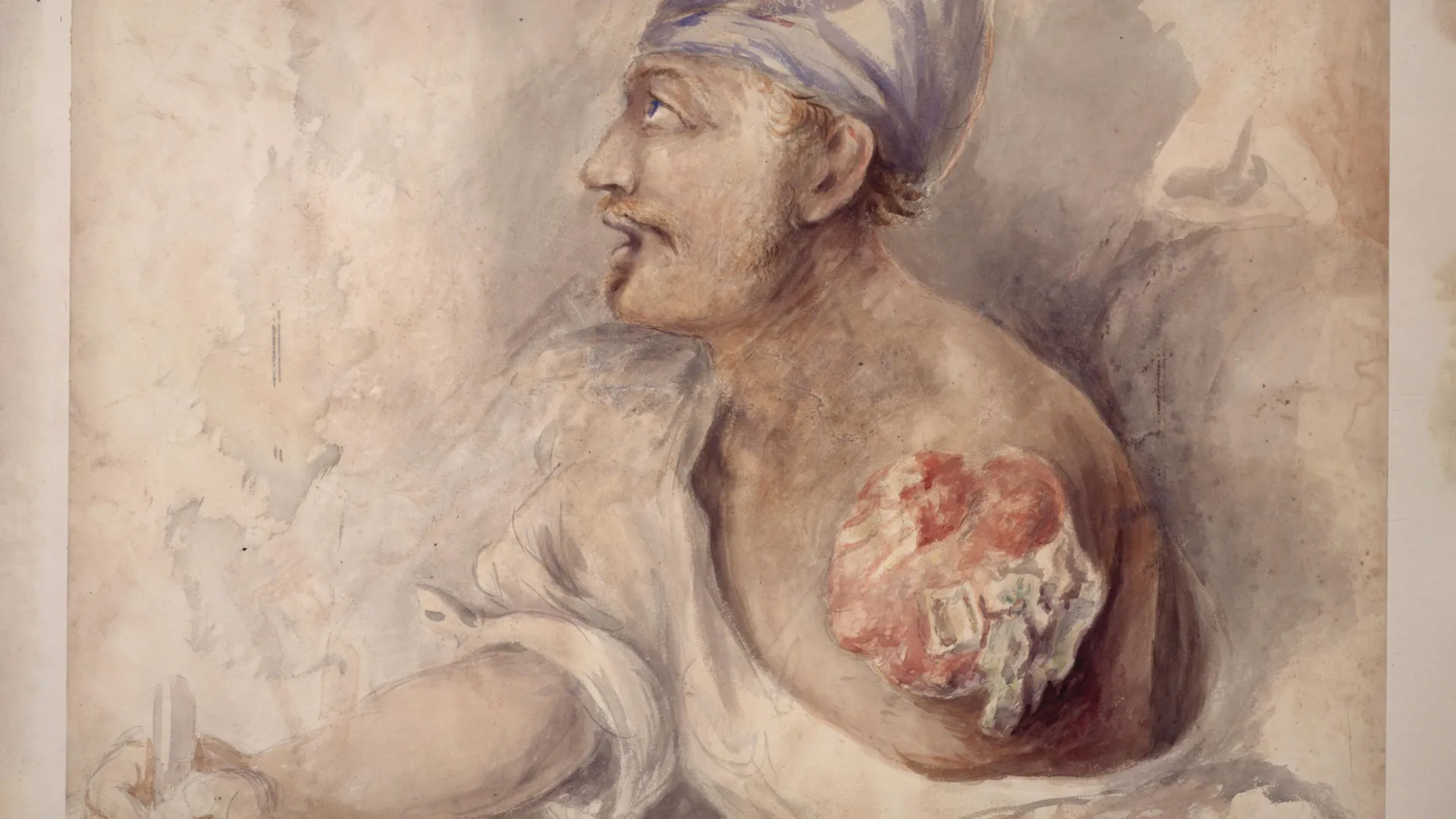 a-war-of-1812-soldier-buried-his-own-arm.-his-real-story-is-even-stranger
