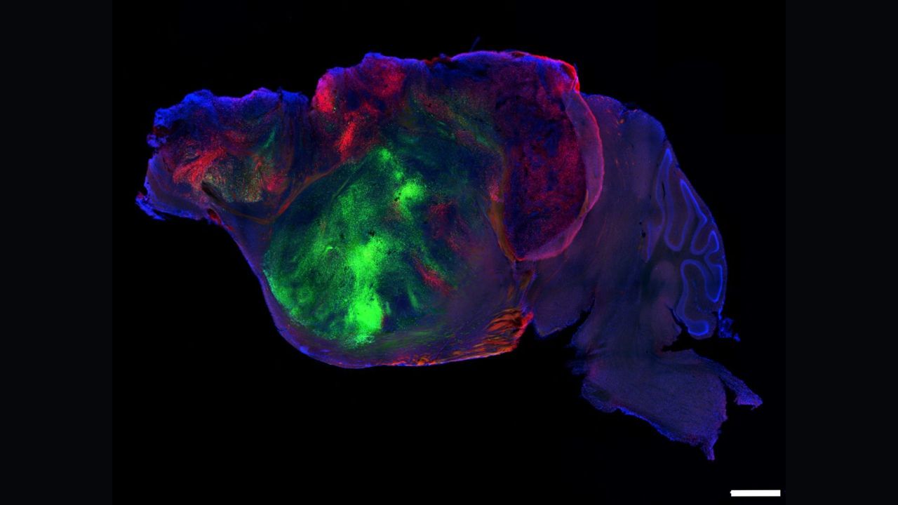 Scientists shrank mice’s brains and replaced the missing tissue with human ‘organoids’