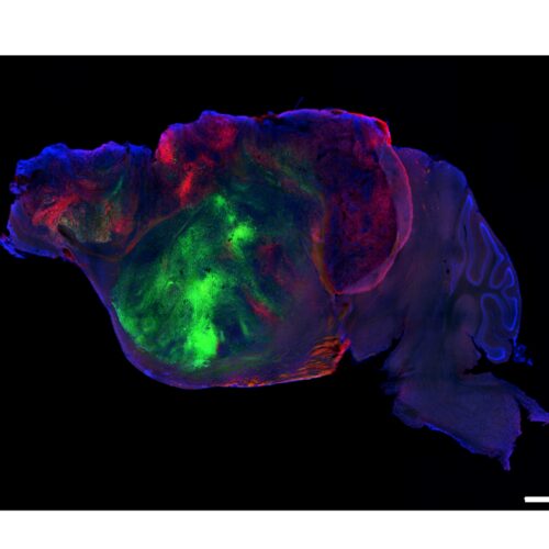 Researchers swap in human brain cells for a mouse’s cortex