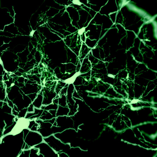 Finding the cells that put our brain to sleep