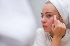 The simple skincare routine for teens that actually works – and five expert tips