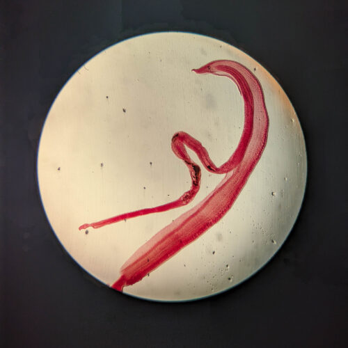 Woman’s brain worm infection confirmed after eggs grow tails in lab test