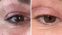 ‘My eyelids became infected – I was scared to sleep’