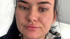 Open wounds and eyes that can’t close – women warn about cheap bleph eyelid surgery