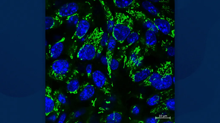 Engineered nanoparticles sensitize gliomas to radiotherapy
