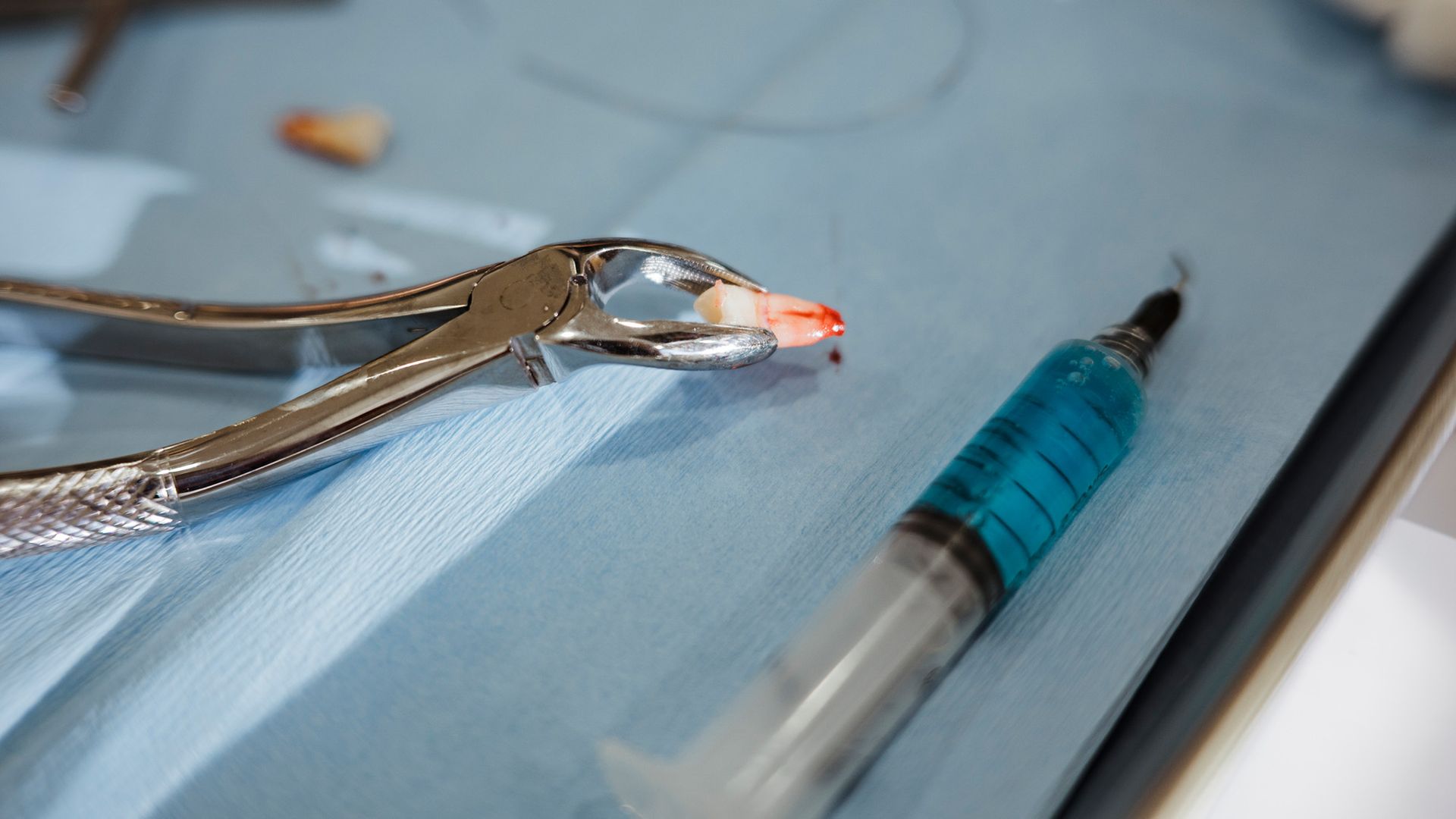 Weird spikes poking through a teen’s eyelid turned out to be a wayward tooth