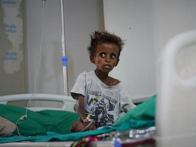 Yemen’s civil war returns and overwhelms hospitals