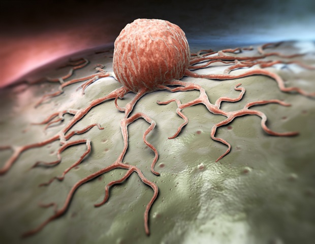 Researchers find how prostate tumors reshape the immune microenvironment