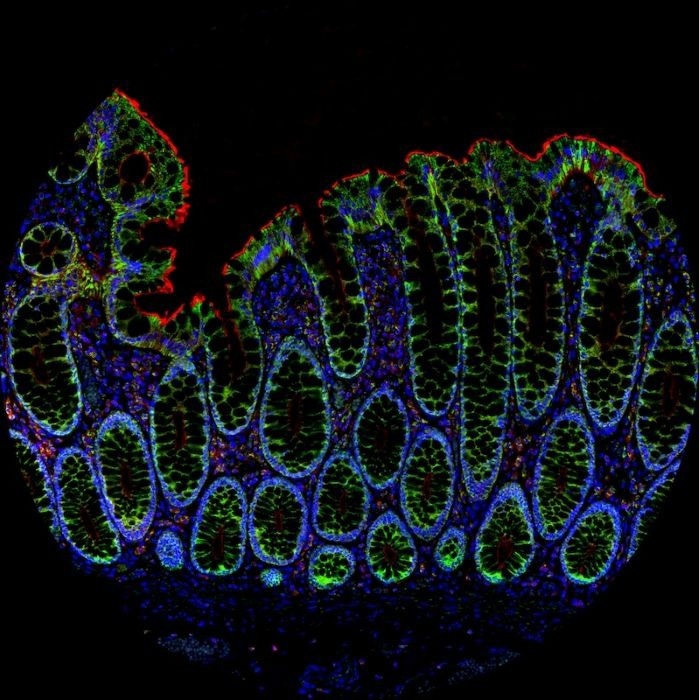 AtlasPlex™ brings custom 5-plex IHC on FFPE tissue into a single day