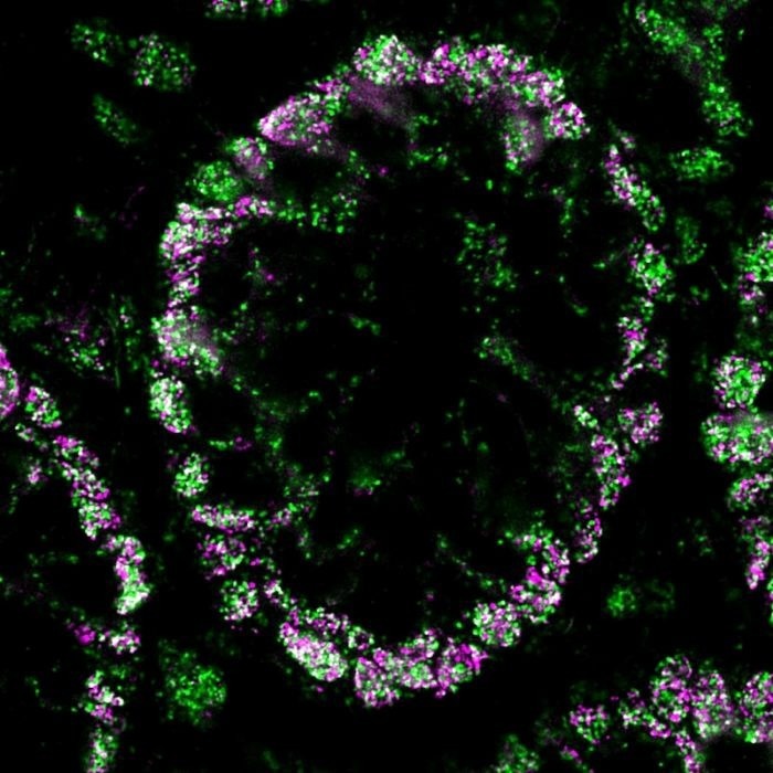 MolBoolean™ measures free and bound proteins in the same experiment