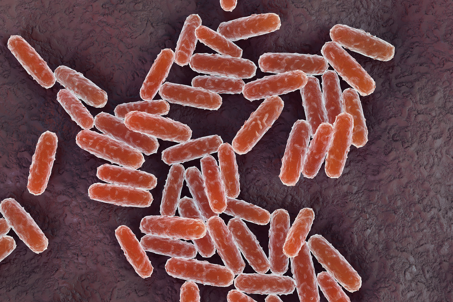 Russian lab worker dies of suspected plague as 200 enter medical observation