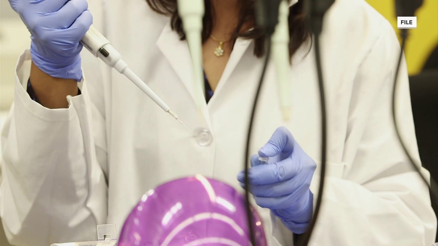 Researcher at Russian Lab Dies After Potential Plague Exposure
