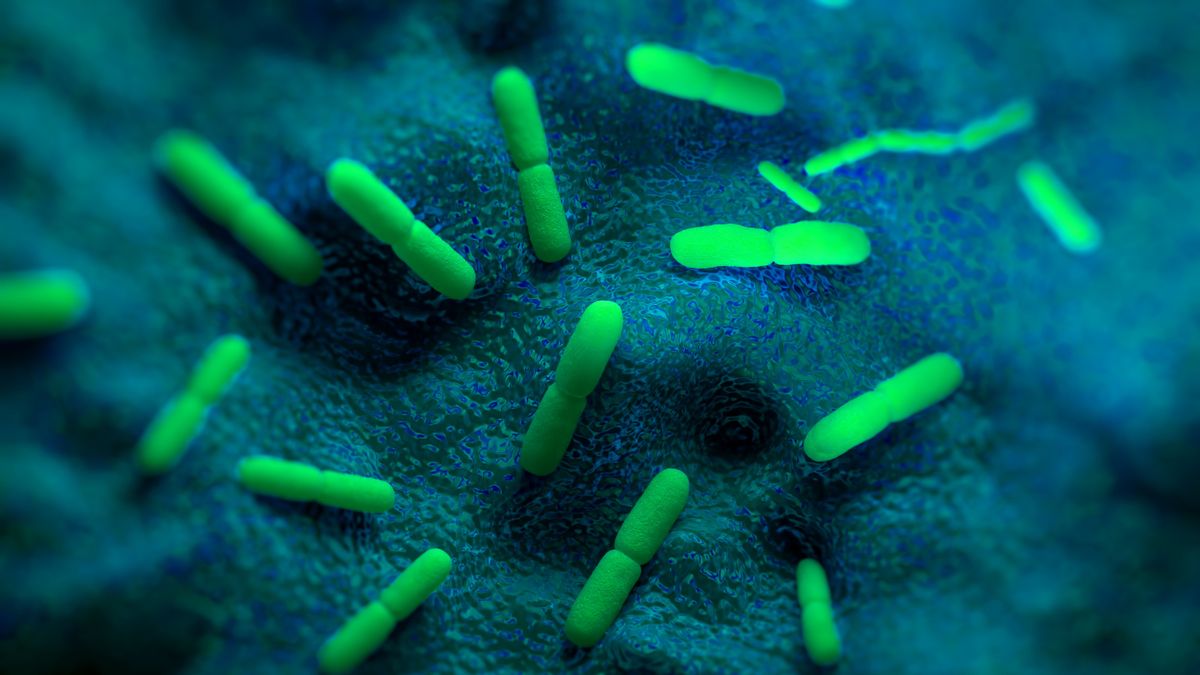 Russian lab worker reportedly died of pneumonic plague. Here’s what we know